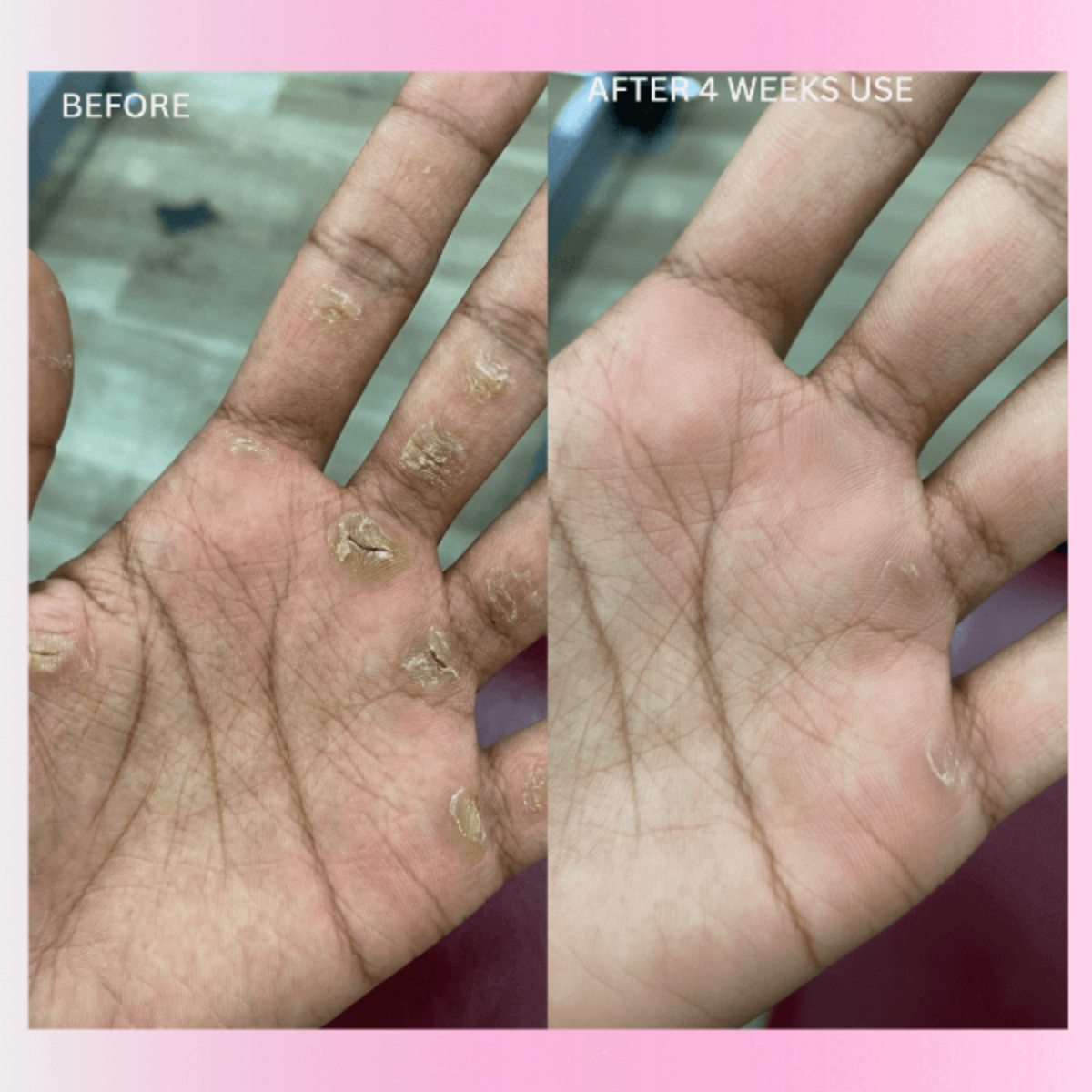 BOLT™ Anti Slip Workout Grip