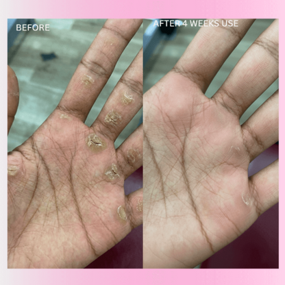 BOLT™ Anti Slip Workout Grip